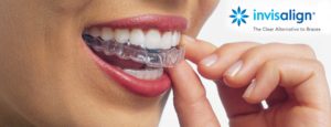 Invisalign - Clinica Ortodoncia Simarro Invisalign - Clinica Ortodoncia Simarro